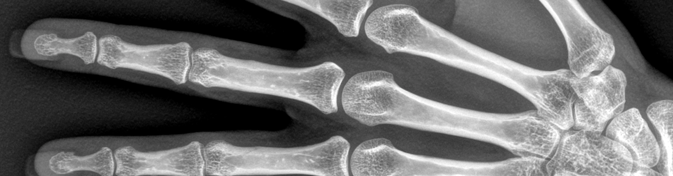 Animal Nutrition and the Skeletal System — Cornerstones curriculum project